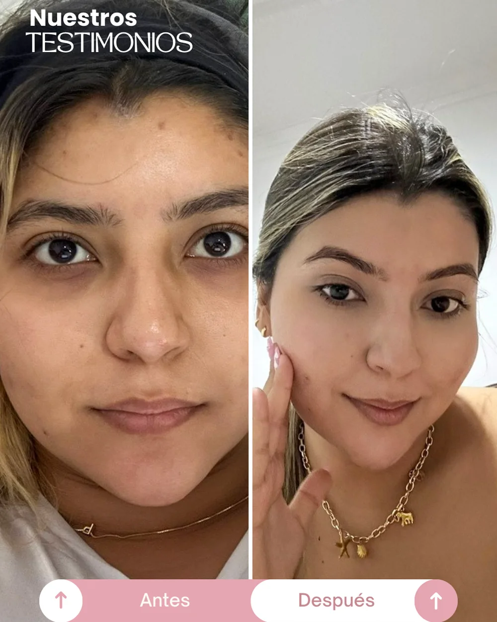 testimonios del tonico despigmentante princess skin (1)