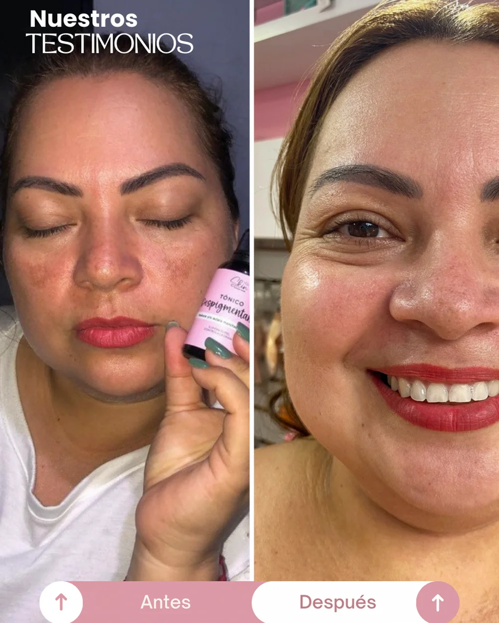 testimonios del tonico despigmentante princess skin (10)