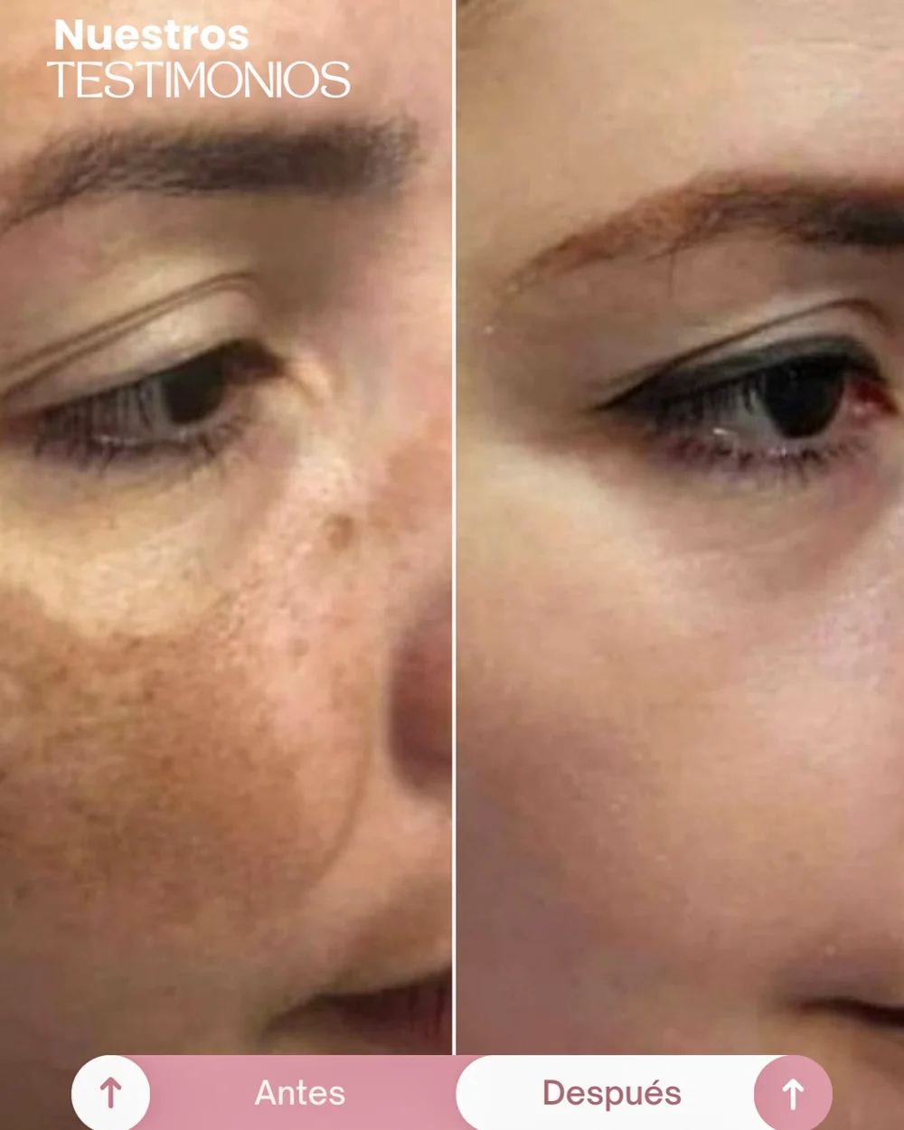 testimonios del tonico despigmentante princess skin (11)