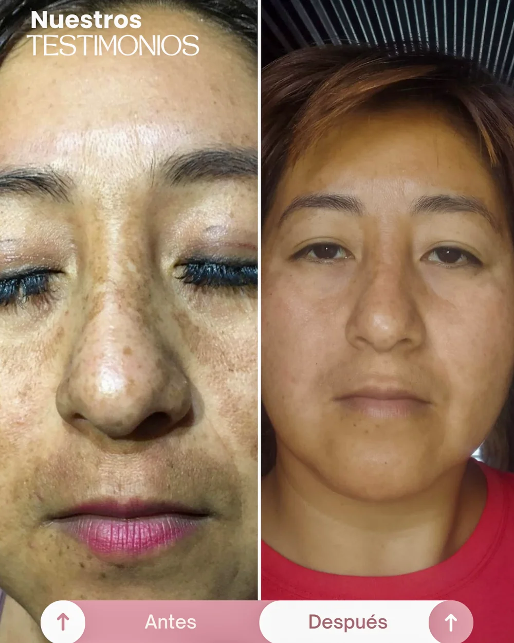 testimonios del tonico despigmentante princess skin (12)