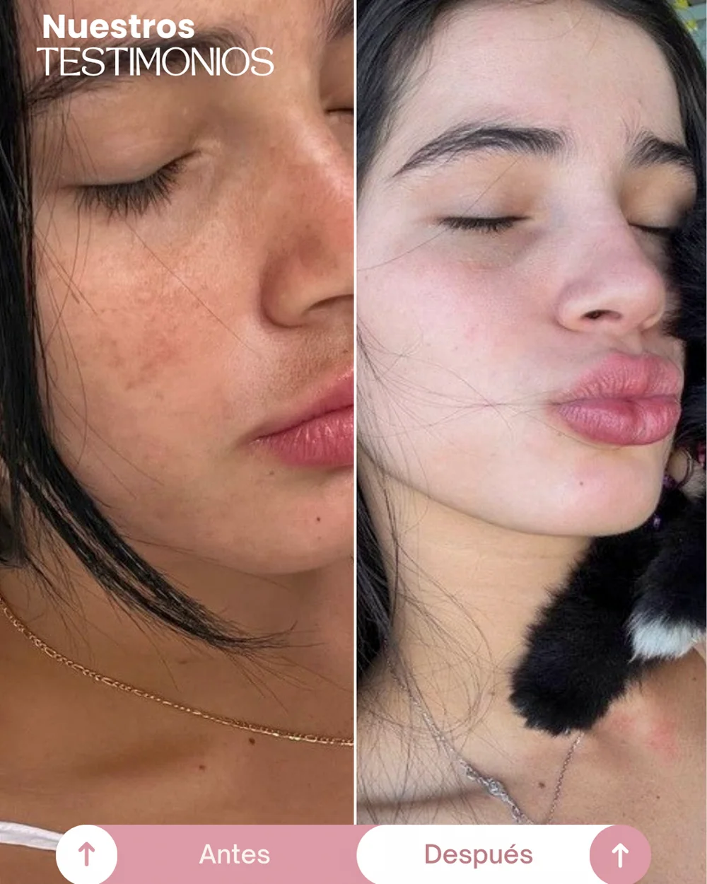 testimonios del tonico despigmentante princess skin (2)