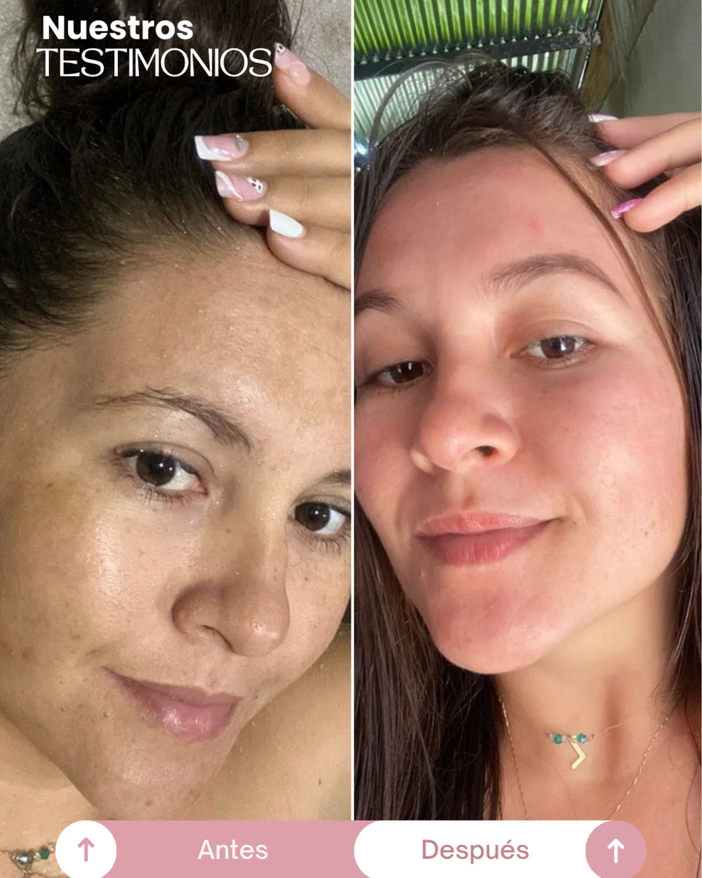 testimonios del tonico despigmentante princess skin (3)