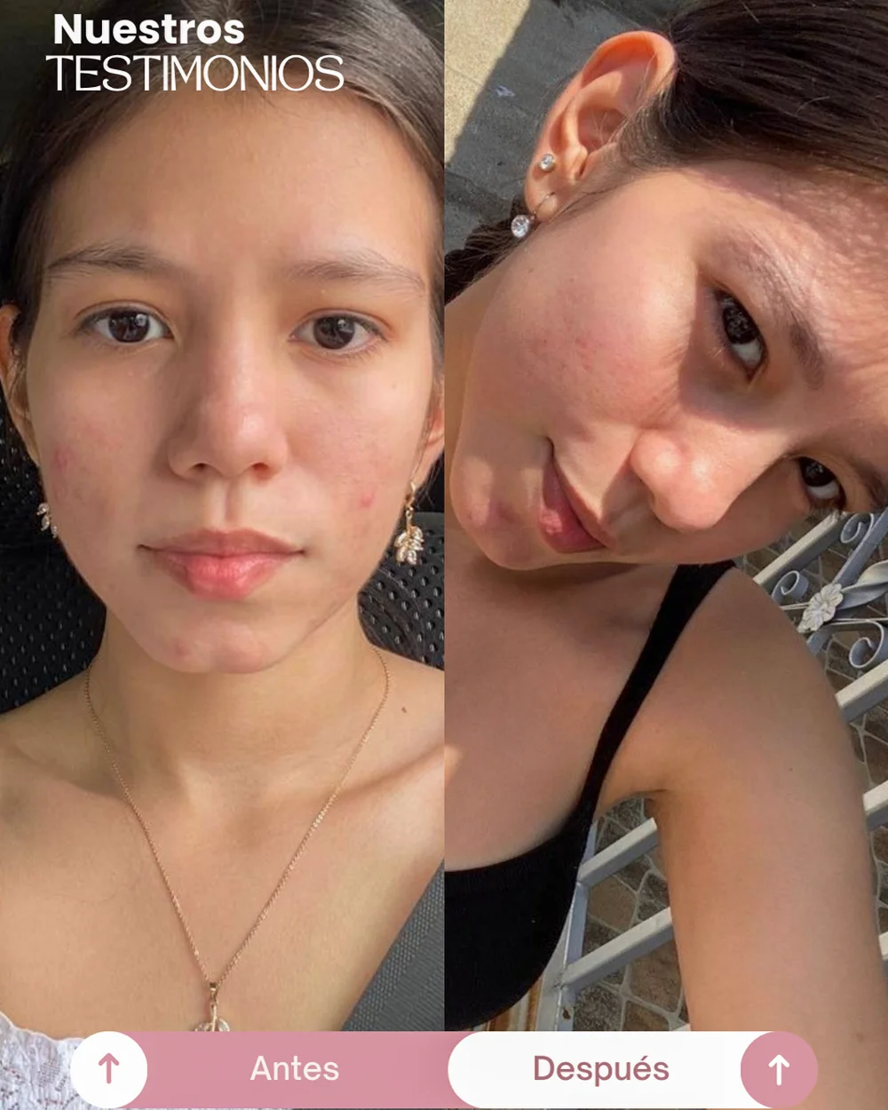 testimonios del tonico despigmentante princess skin (4)