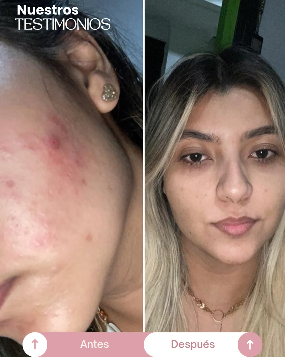 testimonios del tonico despigmentante princess skin (5)