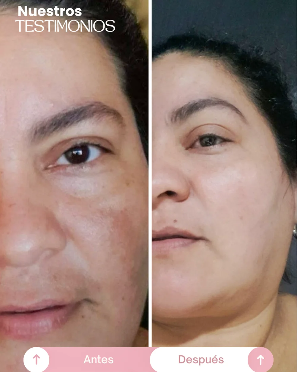 testimonios del tonico despigmentante princess skin (7)