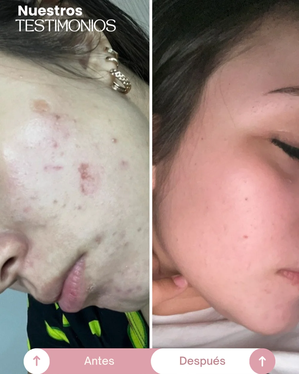 testimonios del tonico despigmentante princess skin (8)