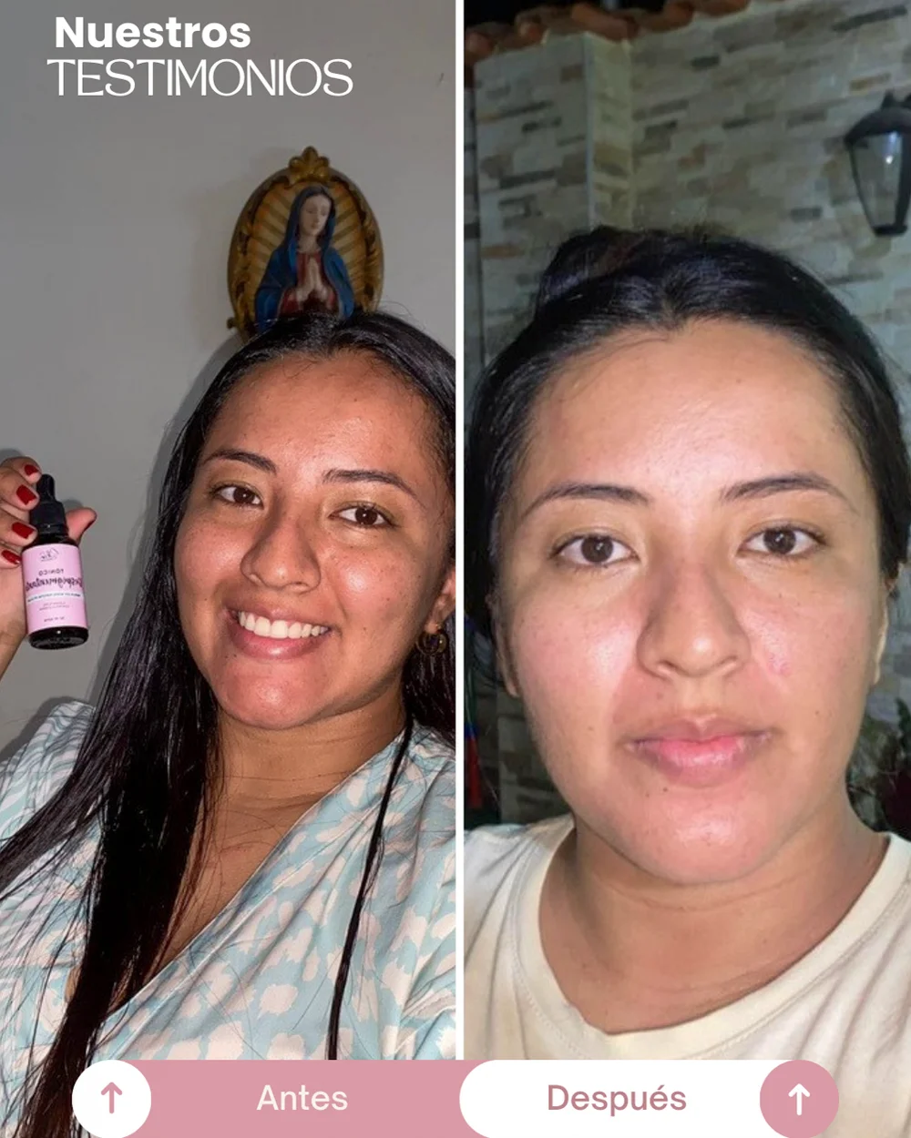 testimonios del tonico despigmentante princess skin (9)
